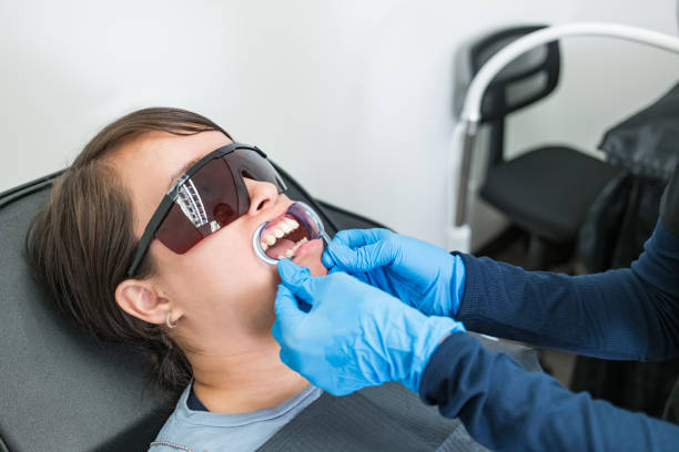 Best Knocked-Out Tooth (Avulsed Tooth) Treatment in Oak Grove, KY